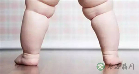 o型腿手术多少钱