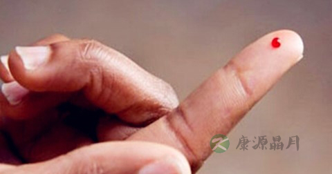 儿童甲肝怎么确诊