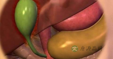 哪几类人容易患胆道结石