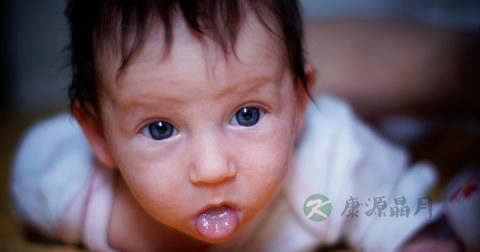 小孩病理黄疸表现 小孩病理黄疸表现