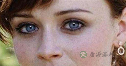 女性更年期的治疗 女性更年期的治疗