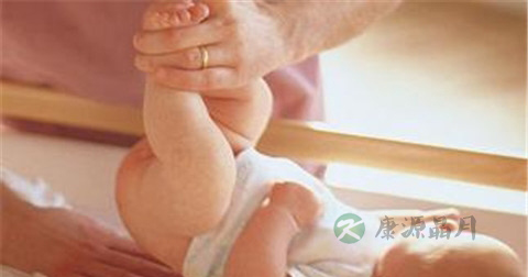 婴儿直肠息肉症状 婴儿直肠息肉症状