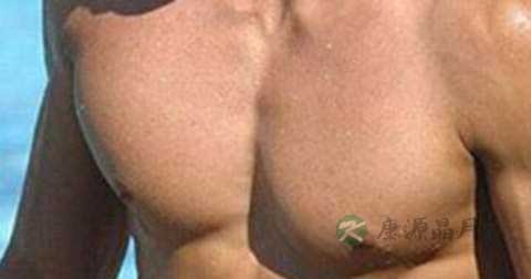 男人乳房痒痛是什么情况 男人乳房痒痛是什么情况