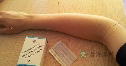断指再生的原理 断指再生的原理