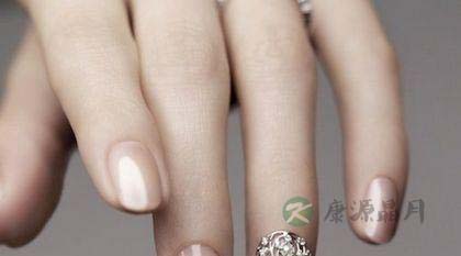 指甲凹凸不平有斑点是什么病 指甲凹凸不平有斑点是什么病