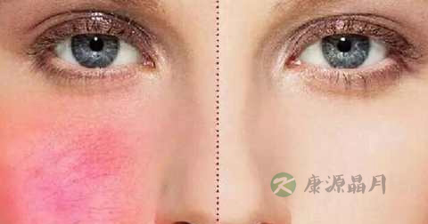 角质层薄吃猪蹄好吗 角质层薄吃猪蹄好吗
