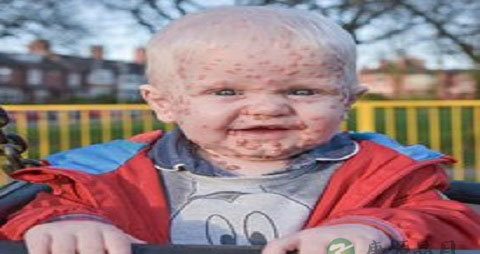 孕妇可以吃花椒粉吗 孕妇可以吃花椒粉吗