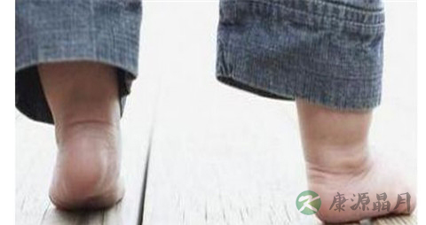 扁平足的治疗方法 扁平足的治疗方法