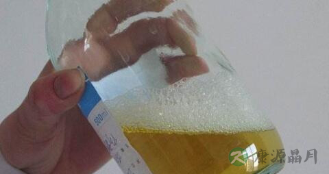 小儿尿蛋白高的原因 小儿尿蛋白高的原因