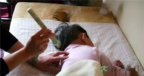 艾灸治疗小儿扁桃体炎怎么样