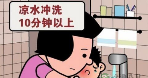 户外烫伤如何自救 户外烫伤如何自救