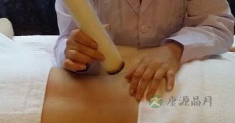 肚脐艾灸可以减肥吗 肚脐艾灸可以减肥吗