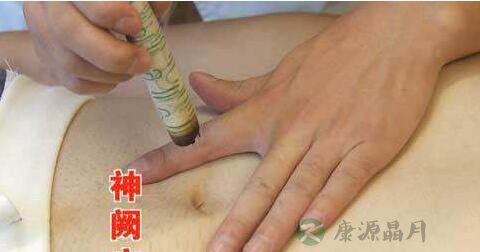 肚脐艾灸可以减肥吗 肚脐艾灸可以减肥吗