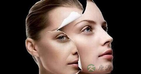 艾炙能减肥吗 艾炙能减肥吗