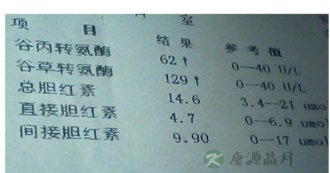 谷丙转氨酶正常值 谷丙转氨酶正常值