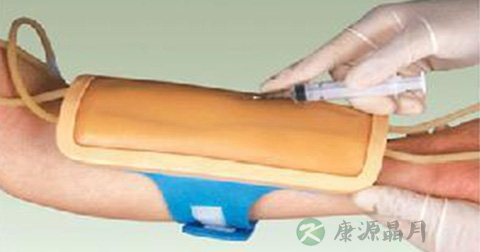 穿刺疼吗 穿刺疼吗