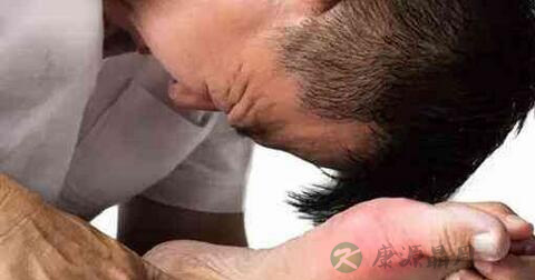 体检尿酸偏高的原因 体检尿酸偏高的原因