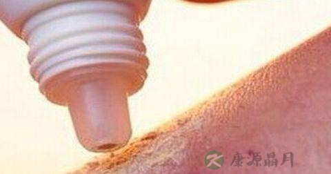 缝针后几天拆线 缝针后几天拆线