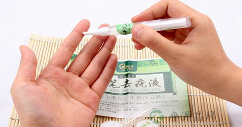 瘊子有什么危害 瘊子有什么危害