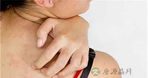 丘疹怎么引起的 丘疹怎么引起的