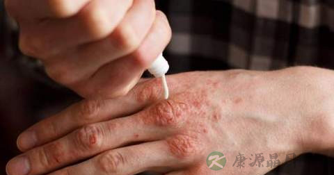 手臂出现白斑原因 手臂出现白斑原因