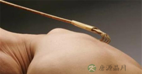 日光性皮炎怎么引起的 日光性皮炎怎么引起的