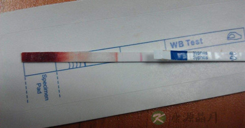 梅毒自测试纸怎么用 梅毒自测试纸怎么用