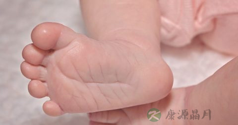 什么是扁平足