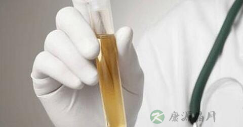 尿常规化验单怎么看 尿常规化验单怎么看