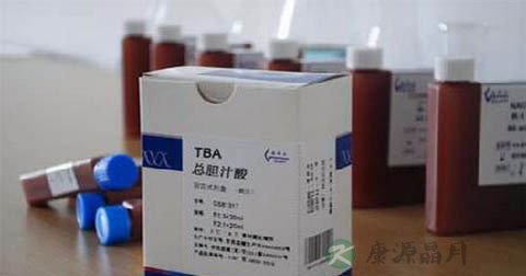 胆汁酸怎么办 胆汁酸怎么办