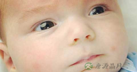长脓疱疮的原因 长脓疱疮的原因