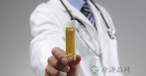 尿常规化验单怎么看 尿常规化验单怎么看