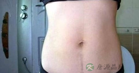 缝针后几天拆线 缝针后几天拆线