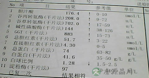 胆汁酸怎么办 胆汁酸怎么办