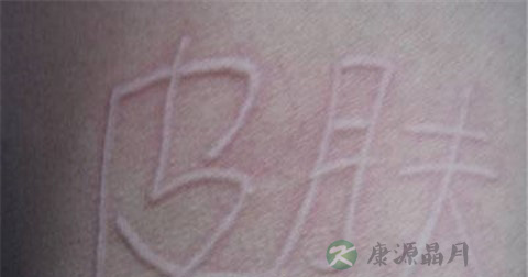玉屏风散配方 玉屏风散配方