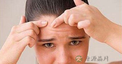痤疮丙酸杆菌怎么治疗 痤疮丙酸杆菌怎么治疗