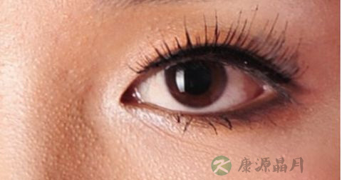 什么是红眼病 什么是红眼病