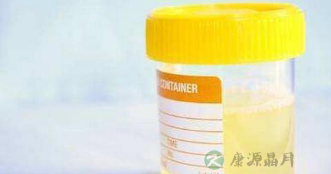 蛋白尿是怎么回事 蛋白尿是怎么回事