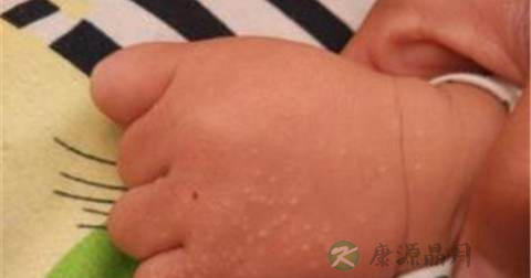 手背上起小疙瘩的原因