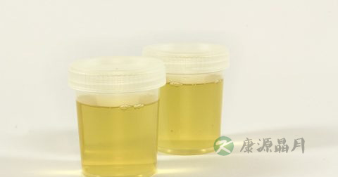 氨基酸尿是怎么回事 氨基酸尿是怎么回事