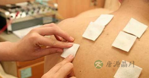 三伏贴的副作用 三伏贴的副作用