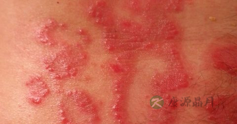 炉甘石洗剂价格 炉甘石洗剂价格