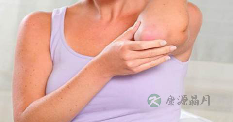 肤克达肤王软膏说明书 肤克达肤王软膏说明书