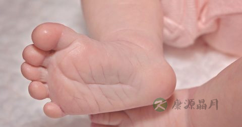 鸡眼膏怎么用 鸡眼膏怎么用