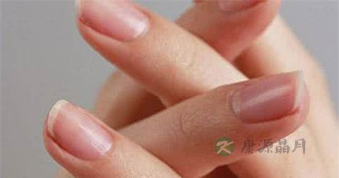 脚上有灰指甲怎么治