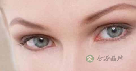 麦粒肿引起的红血丝怎么治 麦粒肿引起的红血丝怎么治