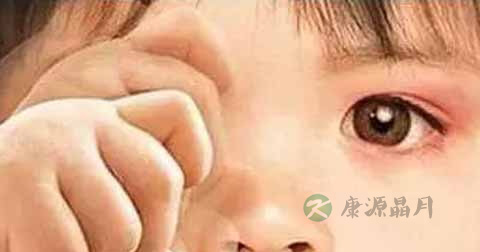 麦粒肿引起的红血丝怎么治 麦粒肿引起的红血丝怎么治