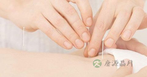 放血治疗法副作用 放血治疗法副作用