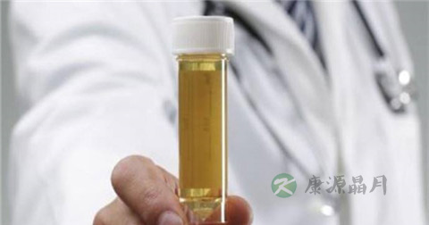 血尿酸偏高怎么治 血尿酸偏高怎么治