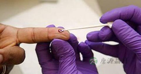 艾滋病检测方法 艾滋病检测方法